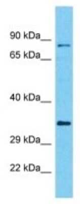 Western Blot: C10orf71 Antibody [NBP3-10741] - Western blot analysis of C10orf71 in HCT15 Whole cell lysates. Antibody dilution at 1.0ug/ml