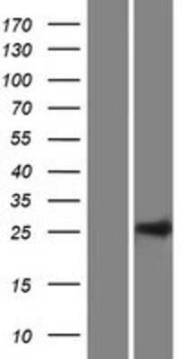 Western Blot: C10orf95 Overexpression Lysate (Adult Normal) [NBP2-06266] Left-Empty vector transfected control cell lysate (HEK293 cell lysate); Right -Over-expression Lysate for C10orf95.