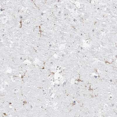 Immunohistochemistry-Paraffin C11orf1 Antibody - BSA Free