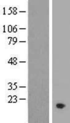 Western Blot: C11orf1 Overexpression Lysate (Adult Normal) [NBL1-08093] Left-Empty vector transfected control cell lysate (HEK293 cell lysate); Right -Over-expression Lysate for C11orf1.