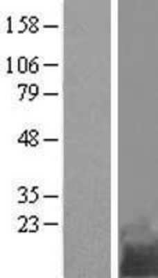 Western Blot: C11orf10 Overexpression Lysate (Adult Normal) [NBL1-08094] Left-Empty vector transfected control cell lysate (HEK293 cell lysate); Right -Over-expression Lysate for C11orf10.
