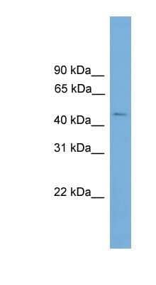 Western Blot: C11orf16 Antibody [NBP1-91488] - Transfected 293T cell lysate, concentration 0.2-1 ug/ml.