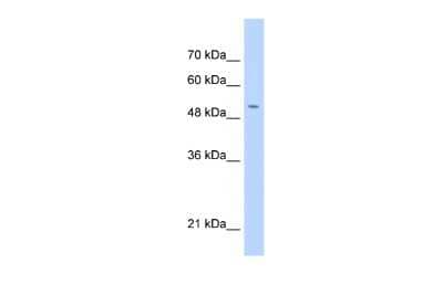 Western Blot C11orf24 Antibody - BSA Free