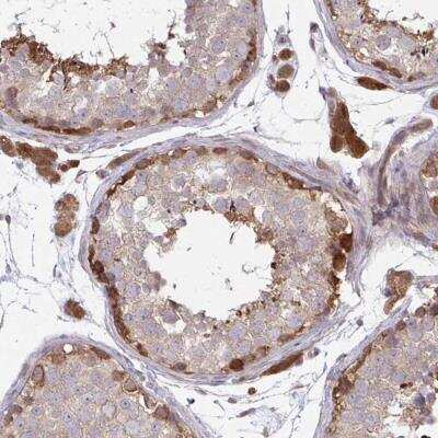 Immunohistochemistry-Paraffin: C11orf35 Antibody [NBP2-31720] - Staining of human testis shows strong cytoplasmic positivity in cells in seminiferus ducts and Leydig cells.