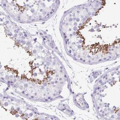 Immunohistochemistry: C11orf42 Antibody [NBP2-38028] - Staining of human testis shows strong cytoplasmic positivity in cells in seminiferus ducts.