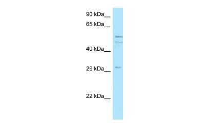 Western Blot: C11orf42 Antibody [NBP2-82815] - WB Suggested Anti-C11orf42 Antibody. Titration: 1.0 ug/ml. Positive Control: MCF7 Whole Cell