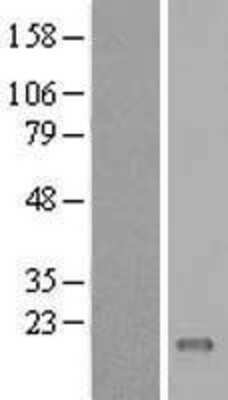 Western Blot: C11orf45 Overexpression Lysate (Adult Normal) [NBL1-08101] Left-Empty vector transfected control cell lysate (HEK293 cell lysate); Right -Over-expression Lysate for C11orf45.