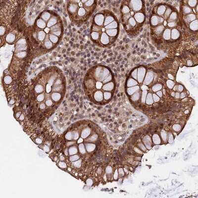 Immunohistochemistry-Paraffin ARL14EP Antibody