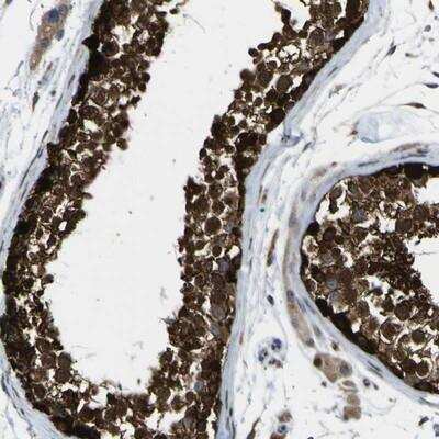 Immunohistochemistry-Paraffin: C11orf48 Antibody [NBP1-81156] - Staining of human testis shows strong nuclear and cytoplasmic positivity in cells of seminiferus ducts.