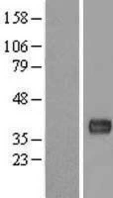 Western Blot: C11orf48 Overexpression Lysate (Adult Normal) [NBL1-08103] Left-Empty vector transfected control cell lysate (HEK293 cell lysate); Right -Over-expression Lysate for C11orf48.