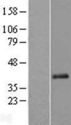 Western Blot: C11orf49 Overexpression Lysate (Adult Normal) [NBL1-08104] Left-Empty vector transfected control cell lysate (HEK293 cell lysate); Right -Over-expression Lysate for C11orf49.