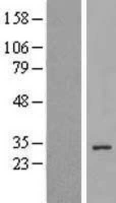 Western Blot: C11orf49 Overexpression Lysate (Adult Normal) [NBL1-08105] Left-Empty vector transfected control cell lysate (HEK293 cell lysate); Right -Over-expression Lysate for C11orf49.