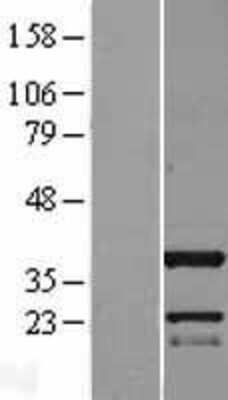 Western Blot: C11orf49 Overexpression Lysate (Adult Normal) [NBL1-08106] Left-Empty vector transfected control cell lysate (HEK293 cell lysate); Right -Over-expression Lysate for C11orf49.