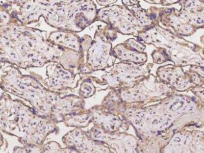 Immunohistochemistry-Paraffin: C11orf52 Antibody [NBP2-97392] - Immunochemical staining of human C11orf52 in human placenta with rabbit polyclonal antibody at 1:100 dilution, formalin-fixed paraffin embedded sections.