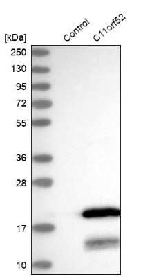 Western Blot: C11orf52 Antibody [NBP2-38409] - Analysis in control (vector only transfected HEK293T lysate) and C11orf52 over-expression lysate (Co-expressed with a C-terminal myc-DDK tag (3.1 kDa) in mammalian HEK293T cells).
