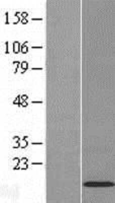 Western Blot: C11orf52 Overexpression Lysate (Adult Normal) [NBL1-08108] Left-Empty vector transfected control cell lysate (HEK293 cell lysate); Right -Over-expression Lysate for C11orf52.