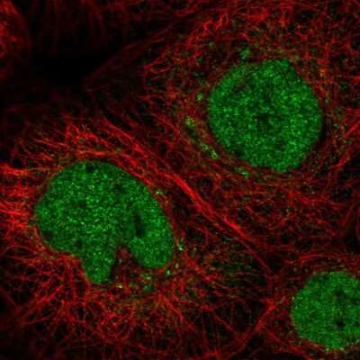 Immunocytochemistry/Immunofluorescence: C11orf63 Antibody [NBP2-55674] - Staining of human cell line A-431 shows localization to nucleoplasm & the Golgi apparatus.