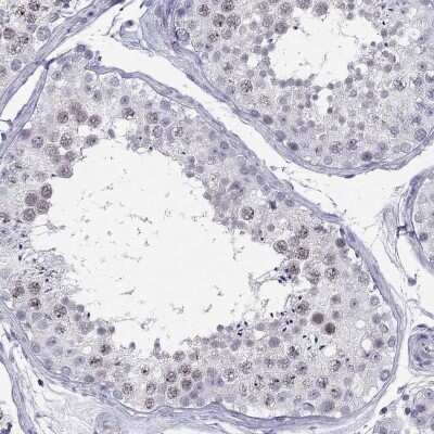 Immunohistochemistry: C11orf63 Antibody [NBP2-69051] - Immunohistochemical staining of human testis shows weak nuclear positivity in cells in seminiferous ducts.