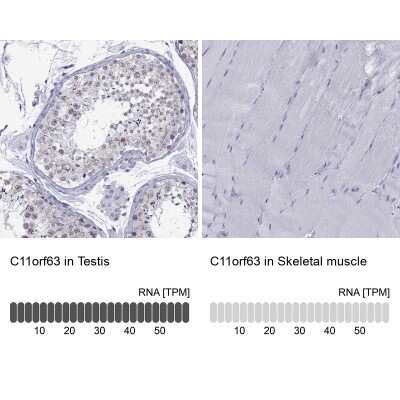 Immunohistochemistry-Paraffin: C11orf63 Antibody [NBP2-62719] - Analysis in human testis and skeletal muscle tissues using Anti-C11orf63 antibody. Corresponding C11orf63 RNA-seq data are presented for the same tissues.
