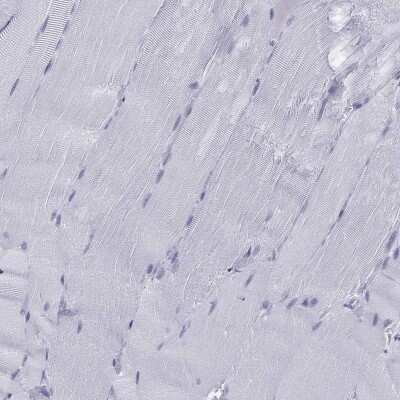 Immunohistochemistry-Paraffin: C11orf63 Antibody [NBP2-62719] - Staining of human skeletal muscle shows low expression as expected.
