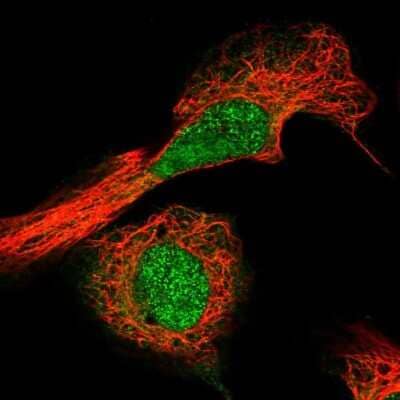 <b>Independent Antibodies Validation. </b>Immunocytochemistry/Immunofluorescence: AAMDC Antibody [NBP2-31969] - Staining of human cell line U-2 OS shows localization to nucleoplasm.