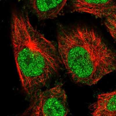 Immunocytochemistry/Immunofluorescence: AAMDC Antibody [NBP2-34040] - Staining of human cell line U-251 MG shows localization to nucleoplasm.