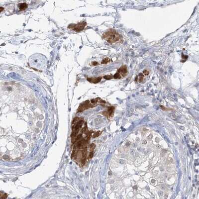 Immunohistochemistry-Paraffin: AAMDC Antibody [NBP2-31969] - Staining of human testis shows distinct cytoplasmic positivity in Leydig cells.