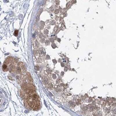 Immunohistochemistry-Paraffin: AAMDC Antibody [NBP2-31969] - Staining of human testis.
