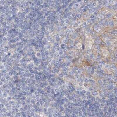 Immunohistochemistry-Paraffin: AAMDC Antibody [NBP2-31969] - Staining of human lymph node.