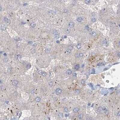 Immunohistochemistry-Paraffin: AAMDC Antibody [NBP2-31969] - Staining of human liver.
