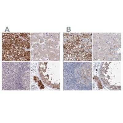 Immunohistochemistry-Paraffin AAMDC Antibody - BSA Free