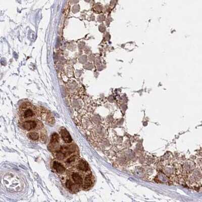 Immunohistochemistry-Paraffin: AAMDC Antibody [NBP2-34040] - Staining of human testis.