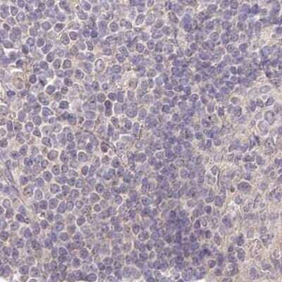 Immunohistochemistry-Paraffin: AAMDC Antibody [NBP2-34040] -  Staining of human lymph node.