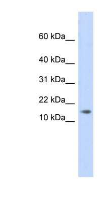 Western Blot: AAMDC Antibody [NBP1-56786] -  Human Placenta lysate, concentration 0.2-1 ug/ml.