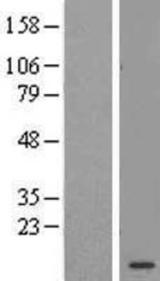 Western Blot: AAMDC Overexpression Lysate [NBL1-08115] - Left-Empty vector transfected control cell lysate (HEK293 cell lysate); Right -Over-expression Lysate for C11orf67.
