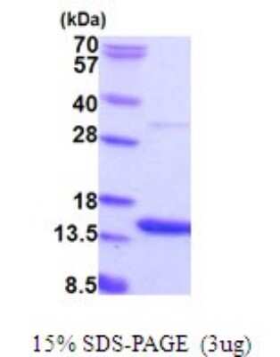 SDS-PAGE Recombinant Human AAMDC His Protein