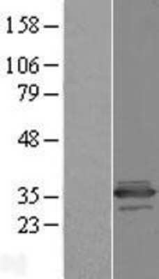 Western Blot: C11orf68 Overexpression Lysate (Adult Normal) [NBL1-08116] Left-Empty vector transfected control cell lysate (HEK293 cell lysate); Right -Over-expression Lysate for C11orf68.