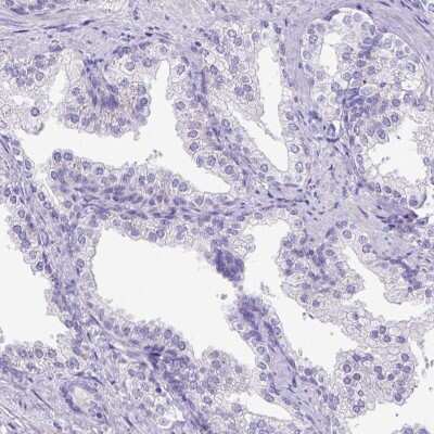 Immunohistochemistry-Paraffin: C11orf70 Antibody [NBP1-81213] - Staining of human prostate shows low expression as expected.