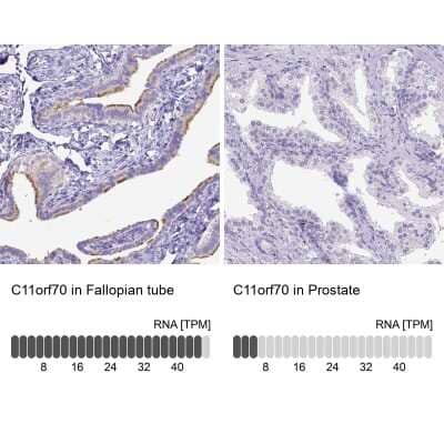 Immunohistochemistry-Paraffin: C11orf70 Antibody [NBP1-81213] - Staining in human fallopian tube and prostate tissues using anti-C11orf70 antibody. Corresponding C11orf70 RNA-seq data are presented for the same tissues.