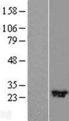 Western Blot: C11orf70 Overexpression Lysate (Adult Normal) [NBL1-08117] Left-Empty vector transfected control cell lysate (HEK293 cell lysate); Right -Over-expression Lysate for C11orf70.