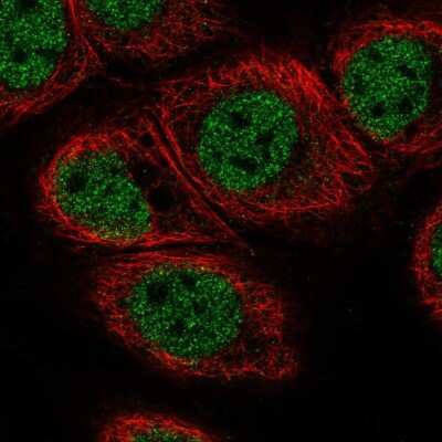 Immunocytochemistry/Immunofluorescence: C11orf71 Antibody [NBP2-56517] - Staining of human cell line HaCaT shows localization to nucleoplasm.