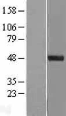 Western Blot: C11orf84 Overexpression Lysate (Adult Normal) [NBL1-12576] Left-Empty vector transfected control cell lysate (HEK293 cell lysate); Right -Over-expression Lysate for C11orf84.
