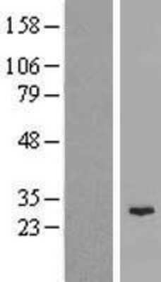 Western Blot: C11orf85 Overexpression Lysate (Adult Normal) [NBP2-08550] Left-Empty vector transfected control cell lysate (HEK293 cell lysate); Right -Over-expression Lysate for C11orf85.