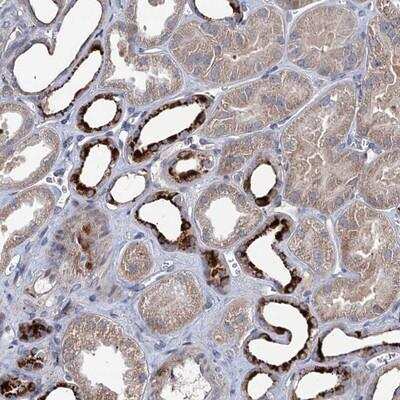 Immunohistochemistry-Paraffin: C11orf86 Antibody [NBP1-93940] - Staining of human kidney shows strong cytoplasmic positivity in subsets of tubules.