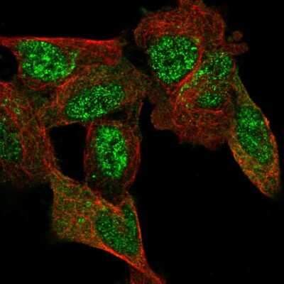 Immunocytochemistry/Immunofluorescence: C11orf96 Antibody [NBP1-90866] - Staining of human cell line SH-SY5Y shows localization to nucleoplasm & cytosol. Antibody staining is shown in green.