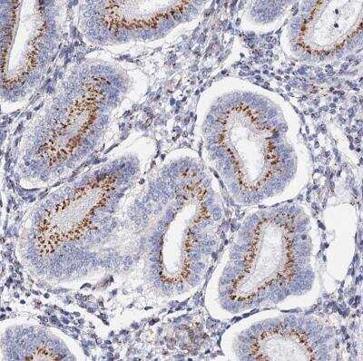 Immunohistochemistry-Paraffin: C11orf96 Antibody [NBP1-90866] - Staining of human endometrium shows strong granular positivity in cytoplasm in glandular cells.