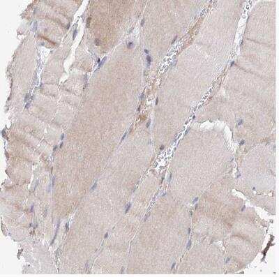 Immunohistochemistry-Paraffin: C11orf96 Antibody [NBP1-90866] - Staining of human skeletal muscle shows very weak positivity in myocytes.