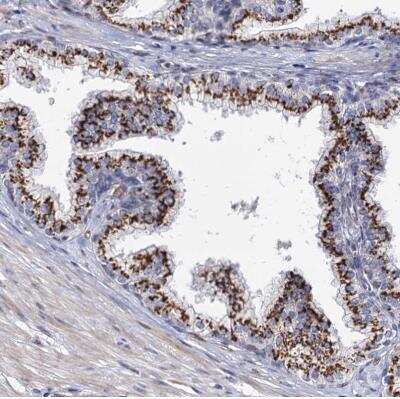 Immunohistochemistry-Paraffin: C11orf96 Antibody [NBP1-90866] - Staining of human prostate shows strong granular positivity in cytoplasm in glandular cells.