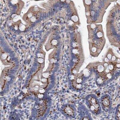 Immunohistochemistry-Paraffin: C11orf96 Antibody [NBP1-90866] - Staining of human small intestine shows strong granular positivity in cytoplasm in glandular cells.