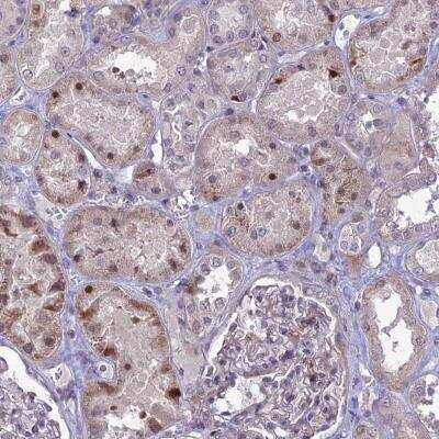 Immunohistochemistry-Paraffin: TMEM263 Antibody [NBP1-81182] - Staining of human kidney shows nuclear and cytoplasmic positivity in cells in tubules.
